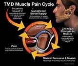 Muscle Pain Doctor Near Me Photos