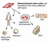 Pictures of Mesenchymal Stem Cells Treatment