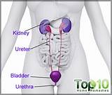 Urinary Tract Infection Home Remedies Pregnancy Images