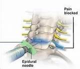 Tri City Pain Management New Braunfels Photos