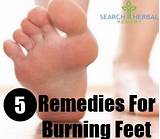 Home Remedies Burning Feet Images