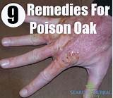 Pictures of Treat Poison Oak Home Remedies