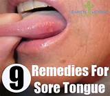 Pictures of Tongue Cracks Home Remedies