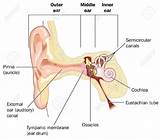 Pressure Sore On Ear Treatment Pictures