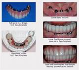 Pictures of Specialist Dental Care