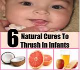 Thrush In Newborns Home Remedies