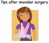 Images of Recovery After Arthroscopic Shoulder Surgery