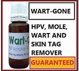 Hpv Wart Removal Home Remedies