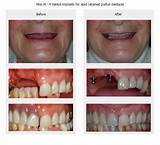 Photos of Specialist Dental Care