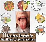 Penile Thrush Home Remedies Photos