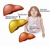Type Of Doctor For Liver Problems Pictures
