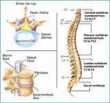 Images of Crooked Spine Chiropractic Treatment