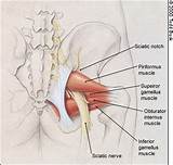 Images of Can Gas Cause Hip Pain