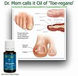 Best Toe Fungus Medication Pictures