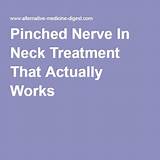 Cervical Pinched Nerve Treatment Images