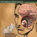 Pictures of What Does Smoking Marijuana Do To The Brain