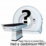 Mri With Gadolinium Contrast Side Effects Images
