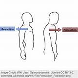 Muscle Exercises In Orthodontics