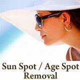 Sun Spot Removal Products