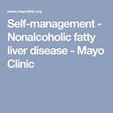 What Is Fatty Liver Mayo Clinic Pictures