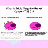 Triple Negative Breast Cancer Treatment Guidelines