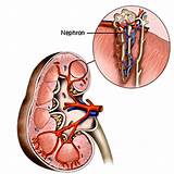 What Type Of Doctor Is A Kidney Specialist