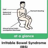 New Medication For Irritable Bowel Syndrome