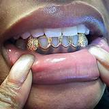 Cheap Gold Grill Images