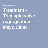 Treatment Of Tricuspid Regurgitation