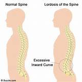 Images of Spine Physical Therapy Exercises