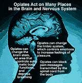 Images of Effects Of Opiate Detox