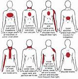 Images of Is Gas A Sign Of Heart Attack