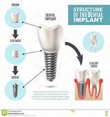 Pictures of Z Dental