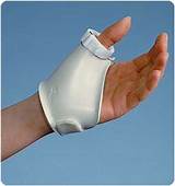 Thumb Arthroplasty Recovery Pictures