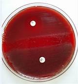 Photos of Blood Agar Plate
