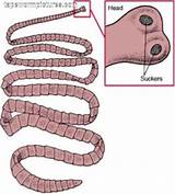 Photos of Beef Tapeworm Treatment