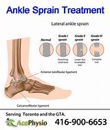 Sprained Ankle Recovery Time Grade 3