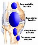 Exercises Knee Bursitis Images