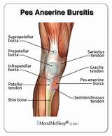 Photos of Pes Anserine Bursitis Treatment Exercises