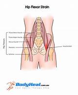 Hip Flexor Strain Recovery Time Images