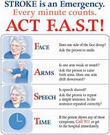 Pictures of Mini Stroke Treatment Recovery