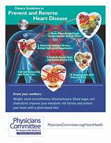 Photos of Migraine Treatment Guidelines 2016