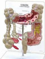 Colon Therapy Images