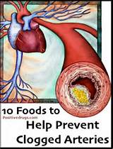Pictures of Clogged Arteries Home Remedies