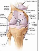 Images of Arthrosis Medical Definition