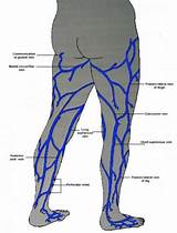 Photos of How Much Is Vein Treatment