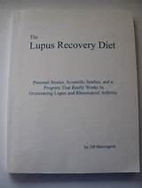 Lupus Recovery Diet Images