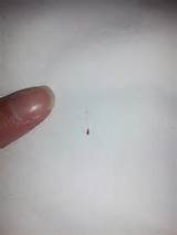 Photos of Boric Acid Bed Bug Control