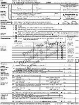 Photos of Itemized Deductions For Mfs