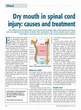 Spinal Cord Injury Hospital